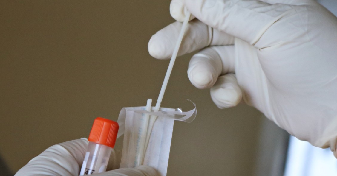 Testes rápidos de antigénio voltam a ser gratuitos