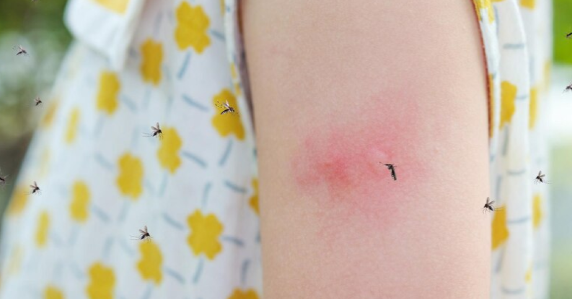Mosquitos